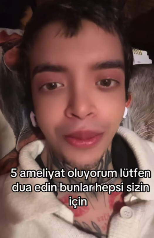 'Tablet Reis' adıyla tanınan Onurcan Güzel 5 ayrı yüz ameliyatı oldu, tanınmaz hale geldi! - Resim: 7