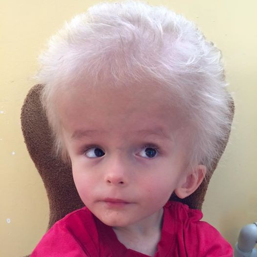 Hastalığı yüzünden ailesi doğar doğmaz terketti ama o pes etmedi - Resim: 2