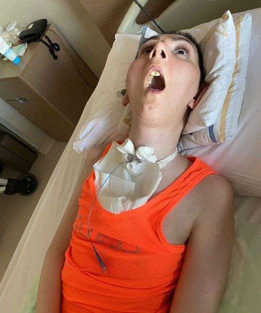 Estetik kabusu oldu! Burun ameliyatı olan kadın 4 yıldır bitkisel hayatta! - Resim: 3