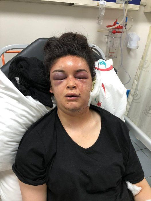 Boşanmak isteyince eşi ve ailesi işkence etti! Ailece işkence cezasız kalmadı - Resim: 2