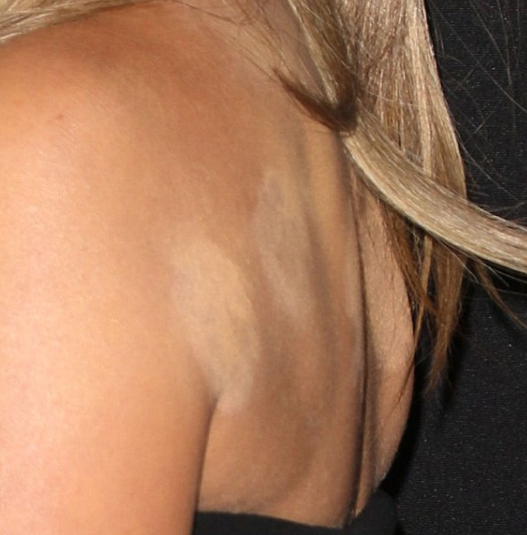 Jennifer Aniston'ın sırtına ne oldu? - Resim: 4