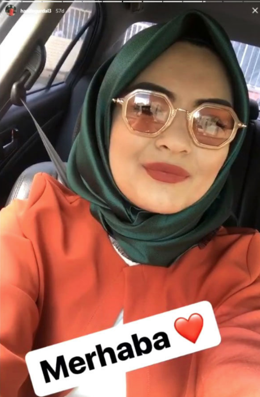 Gelin adayı Hanife Gürdal estetik yaptırdı son halini görenler tanıyamadı - Resim: 4