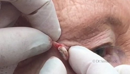 Siyah nokta sandı ama bakın ne çıktı? - Resim: 4