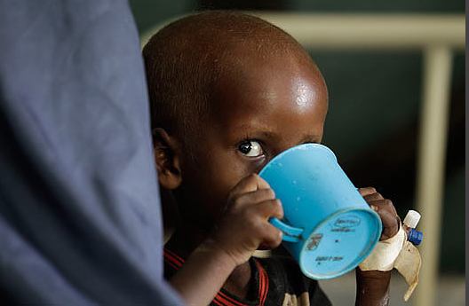 Somali'de çocuklar açlıktan ölüyor - Resim: 2