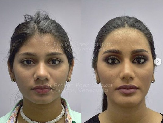 Venezuella Güzeli'nin eski hali görenleri şaşırttı - Resim: 3