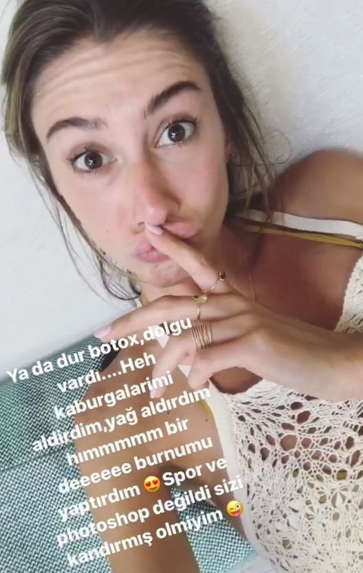 Şeyma Subaşı ''Her yerimi yaptırdım''  - Resim: 4