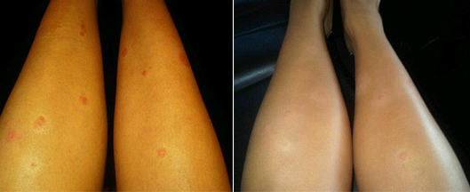 Bu hastalık ünlü yıldızı mahvetti - Resim: 2