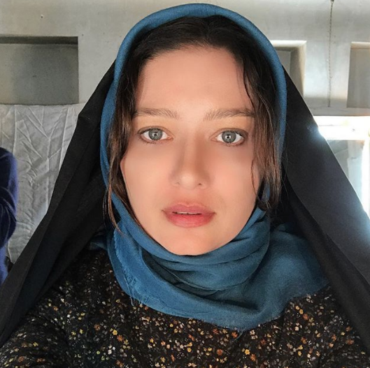 Botokslu hali korkunçtu! Nurgül Yeşilçay'ın inanılmaz değişimi - Resim: 3