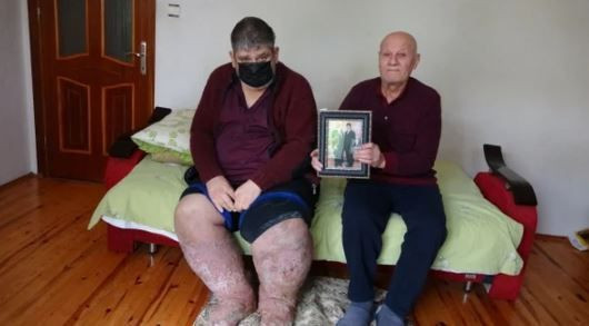 'Ölüm belki kurtuluşumdur' demişti, sivrisineğin ısırdığı güvenlik görevlisi yaşama tutunamadı - Resim: 3