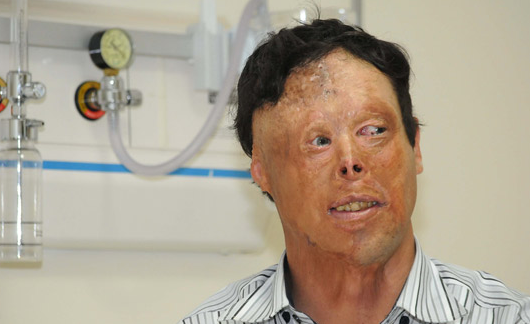 Nakilden sonra ilk kez basının karşısında - Resim: 3