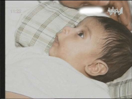 Bebeğin içinden bebek çıktı - Resim: 4