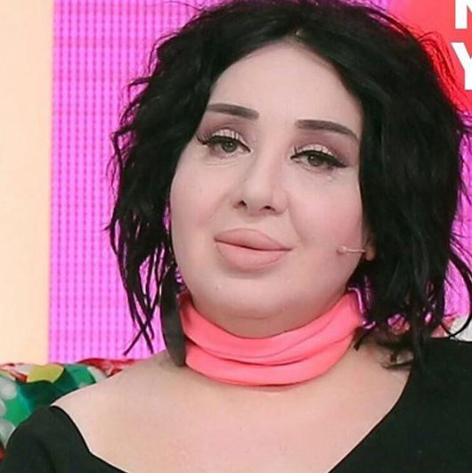 Nur Yerlitaş'ı görenler şoke oldu zayıfladı zayıflamasına ama... - Resim: 1