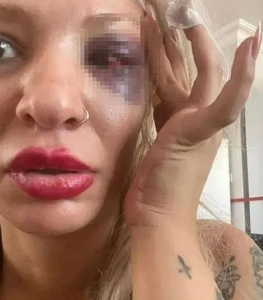 Kemik kıran gitaristin savunması yok artık dedirtti! Sevgilisini darp eden Can Tunaboylu'ya 6 yıl 6 aya kadar hapis istemi - Resim: 1