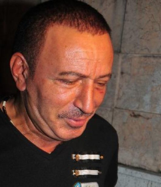 İşte botokslu Mustafa Topaloğlu - Resim: 2