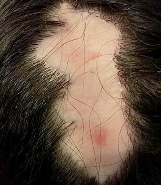 Kuaför hatası bakın ne yaptı korkunç! - Resim: 4