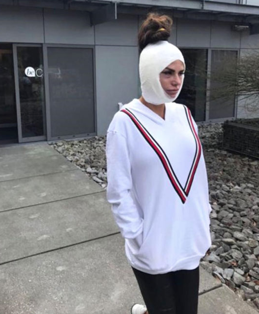 Ünlü şarkıcının son hali korkuttu! Güzellik uğruna bu yapılır mı - Resim: 2