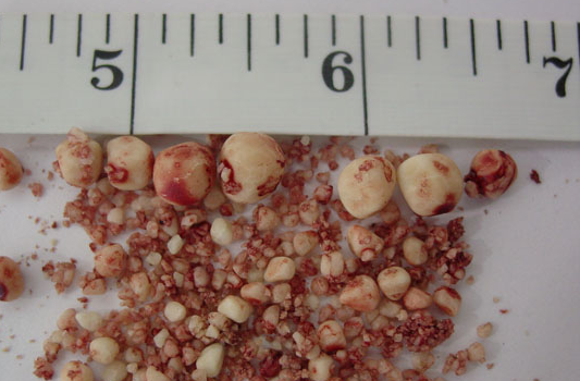 İşte orucu bozmayan durumlar - Resim: 4