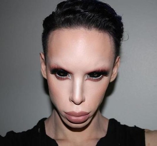 Cinsiyetsiz olmak için 110 ameliyat geçirdi - Resim: 1