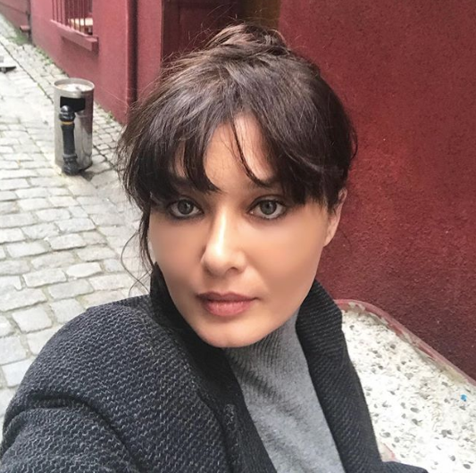Botokslu hali korkunçtu! Nurgül Yeşilçay'ın inanılmaz değişimi - Resim: 4