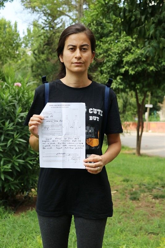 Kedileri besleyen öğretmenin başına gelmeyen kalmadı - Resim: 4