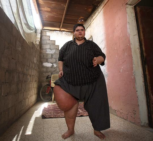 400 kilo olan genç yardım bekliyor - Resim: 3