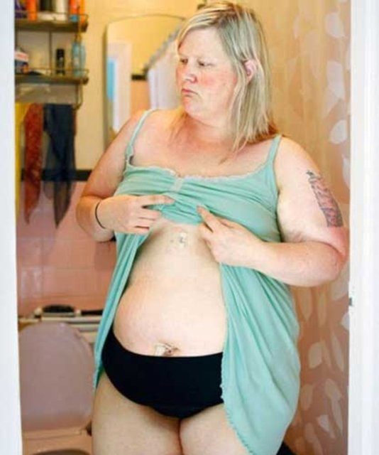 Zayıflamak için tam 11 yıl boyunca yaptığına inanamayacaksınız! - Resim: 2