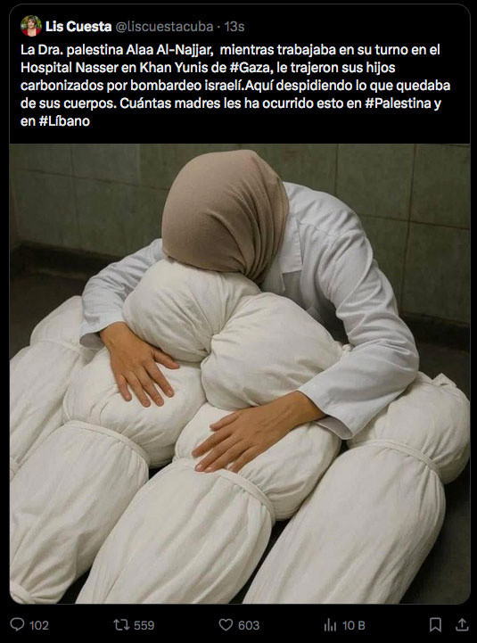 Filistin'de 10 çocuğundan 9'unu kaybeden çocuk doktoru Ala en-Neccar dünyayı kahretti - Resim: 2