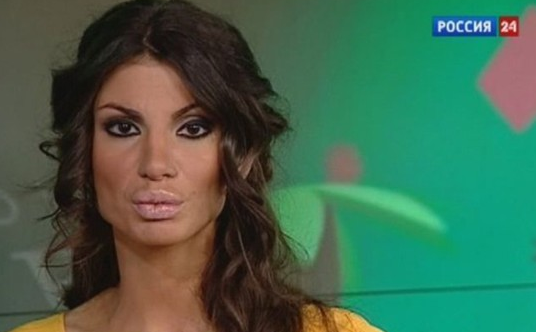 Dudaklarını görenler gözlerine inanamadı - Resim: 4