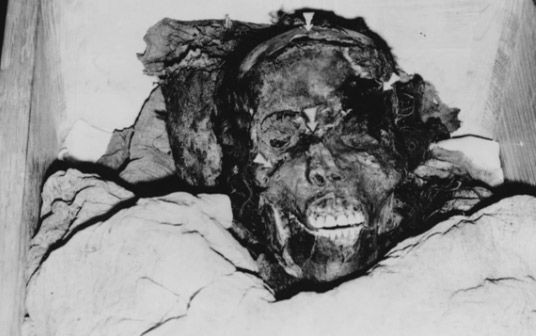 Firavunun tomografisi çekildi eski mumyacıların gizlemeye çalıştığı gerçek dehşete düşürdü - Resim: 3