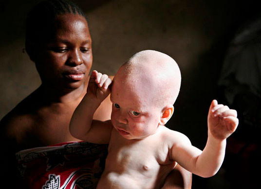 Öldürüp bedenlerini satıyorlar - Resim: 2