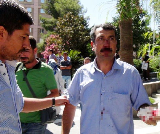 Fakıbaba'nın güvenlikleri vatandaşı hastanelik etti - Resim: 3