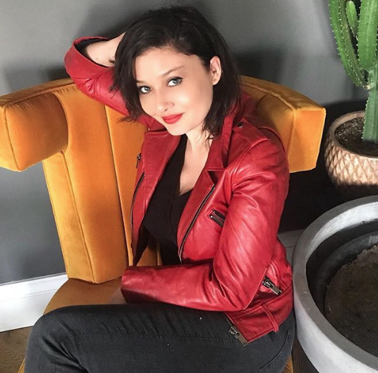 Botokslu hali korkunçtu! Nurgül Yeşilçay'ın inanılmaz değişimi - Resim: 2