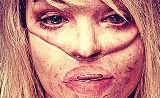 110 ameliyattan sonra yeniden mutlu! - Resim: 2