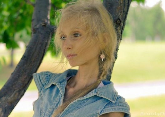 Zayıflık takıntısı bu hale getirdi - Resim: 1