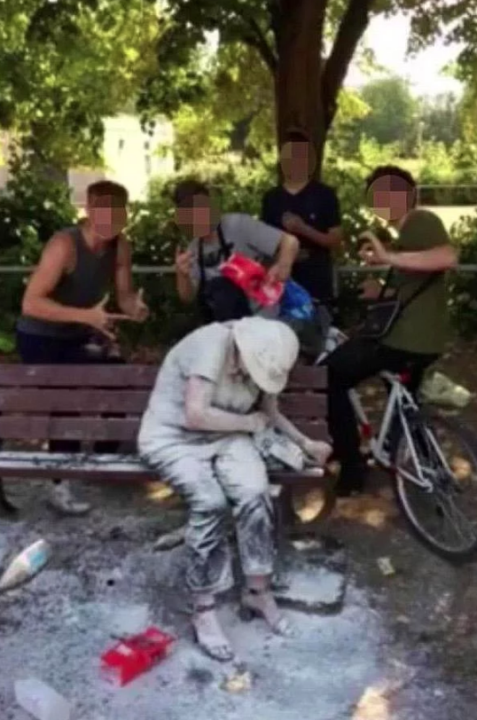 Parkta oturan engelli kadını bu hale getirdiler! İnsanlık artık bitti - Resim: 2