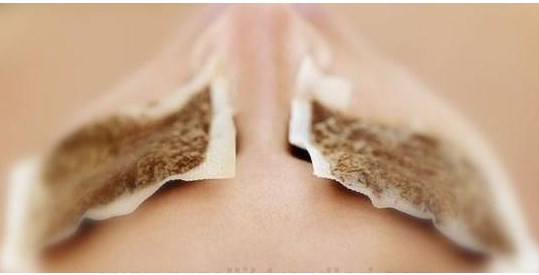 Günde kaç fincan çay içiyorsunuz? - Resim: 3