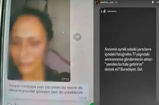 "Tehdit ve şiddet" iddiasıyla mahkemeye koştu! Neslihan Acar'dan, Levent İnanır'a uzaklaştırma kararı - Resim: 5