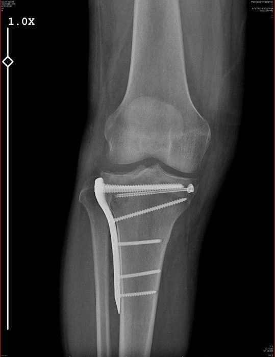Bu nasıl polis! 8.5 milyon liralık arabaya biniyor, lüks villada yaşıyor, yol kesip avukat dövüyor - Resim: 4
