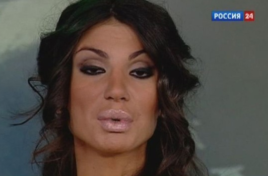 Dudaklarını görenler gözlerine inanamadı - Resim: 2