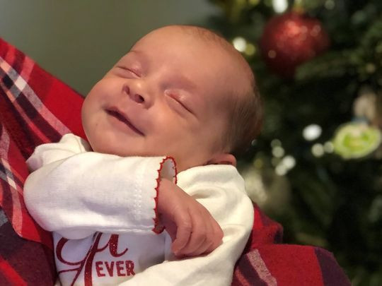 Bu bebek aslında 24 yaşında inanılmaz ama gerçek - Resim: 2