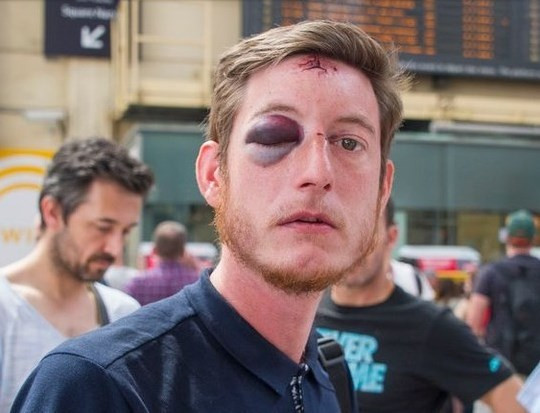 İngiliz taraftar bu hale geldi - Resim: 4