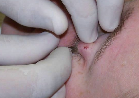 Gençlerin bu çılgınlığı dehşete düşürüyor - Resim: 2