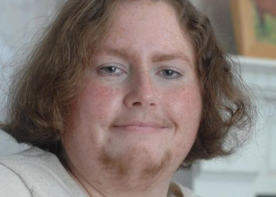 Sakallı kadın görenleri dehşete düşürdü - Resim: 3