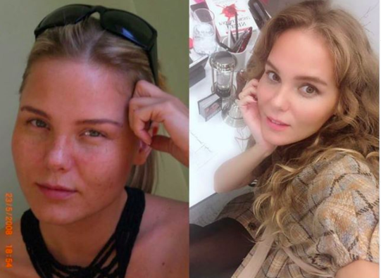 Melike Öcalan evli mi kaç yaşında? Melike Öcalan son hali nasıl? - Resim: 2