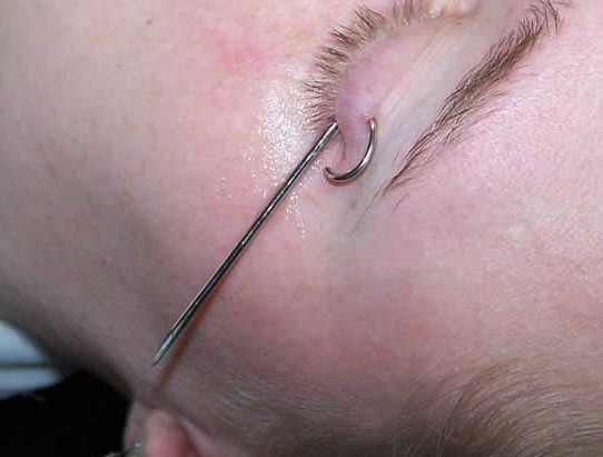 Gençlerin bu çılgınlığı dehşete düşürüyor - Resim: 3