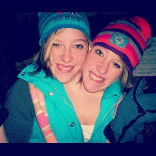 Onlar tek beden de iki ayrı dünya yapışık ikizler dünyayı şaşırttı - Resim: 2