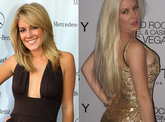 Estetikle güzelleşeyim derken... - Resim: 2