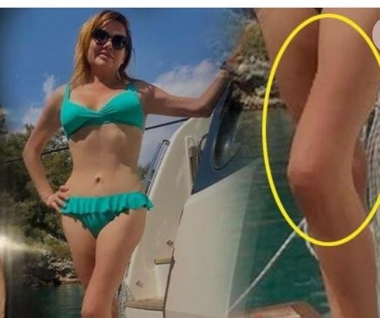 Deniz Seki Photoshop yüzünden ti'ye alındı, zayıflık sırrı 'Buz terapisi' imiş! - Resim: 1