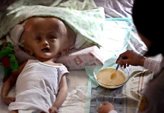 Bu çocuğun kafası sürekli büyüyor - Resim: 2