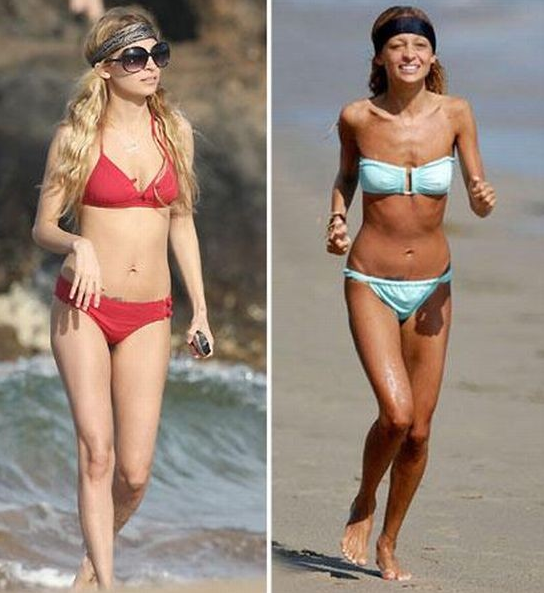 Ünlülerin bu halleri korkutuyor! - Resim: 4